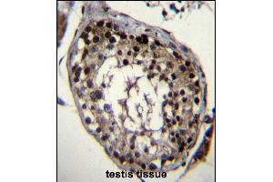 DAZ4 Antibody (Center) (ABIN656487 and ABIN2845764) immunohistochemistry analysis in formalin fixed and paraffin embedded human testis tissue followed by peroxidase conjugation of the secondary antibody and DAB staining. (DAZ4 抗体  (AA 90-119))