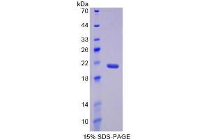 SDS-PAGE (SDS) image for Complement Component 5 (C5) (AA 1541-1688) protein (His tag) (ABIN1880099)