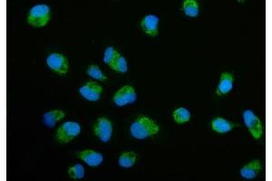 IF analysis of ECSIT using anti-ECSIT antibody (ABIN7602543).
