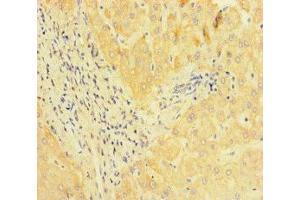 Immunohistochemistry of paraffin-embedded human liver tissue using ABIN7164549 at dilution of 1:100 (JMJD1C 抗体  (AA 539-648))