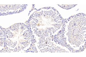 Detection of CHRDL1 in Mouse Testis Tissue using Polyclonal Antibody to Chordin Like Protein 1 (CHRDL1) (CHRDL1 抗体  (AA 272-447))