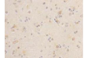Immunohistochemistry (Paraffin-embedded Sections) (IHC (p)) image for anti-Leucine-Rich Repeat Containing G Protein-Coupled Receptor 5 (LGR5) antibody (ABIN1112906) (LGR5 抗体)