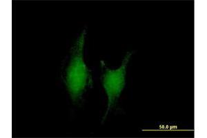 Immunofluorescence of purified MaxPab antibody to TRAF5 on HeLa cell. (TRAF5 抗体  (AA 1-557))