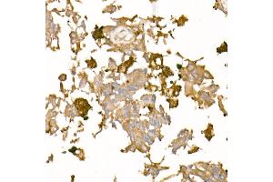 Immunohistochemistry (IHC) image for anti-Tubulin, alpha 4a (TUBA4A) antibody (ABIN7271036)