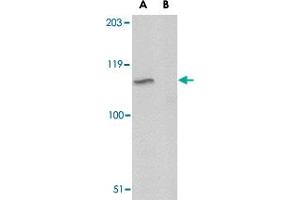 Western blot analysis of GP6 in A-20 lysate with GP6 polyclonal antibody  at 1 ug/m in either the absence or (B) the presence of blocking peptide. (GP6 抗体  (C-Term))