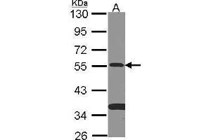 WB Image Sample (30 ug of whole cell lysate) A: NT2D1 10% SDS PAGE antibody diluted at 1:500 (SMAD9 抗体)