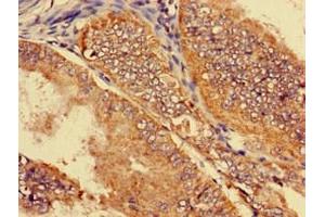 Immunohistochemistry (IHC) image for anti-Solute Carrier Family 22 (Organic Cation Transporter), Member 2 (SLC22A2) (AA 48-135) antibody (ABIN7170144)