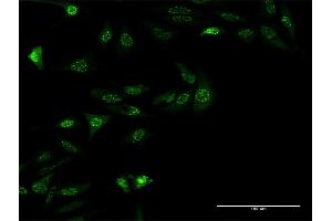 Immunofluorescence of monoclonal antibody to ZSCAN18 on HeLa cell. (ZSCAN18 抗体  (AA 1-510))