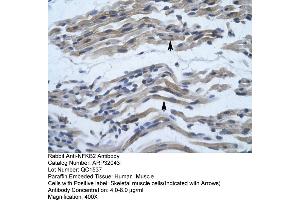 Immunohistochemistry (IHC) image for anti-Nuclear Factor of kappa Light Polypeptide Gene Enhancer in B-Cells 2 (NFKB2) (C-Term) antibody (ABIN2779436)