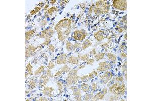 Immunohistochemistry of paraffin-embedded human stomach using BCR antibody at dilution of 1:100 (x40 lens). (BCR 抗体)