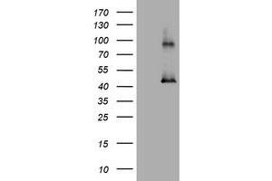 Image no. 1 for anti-Melanoma Antigen Family A, 3 (MAGEA3) antibody (ABIN1499258) (MAGEA3 抗体)