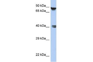 WB Suggested Anti-ZNF429 Antibody Titration:  0. (ZNF429 抗体  (N-Term))