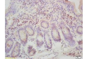 Immunohistochemistry (IHC) image for anti-Solute Carrier Family 11 (Proton-Coupled Divalent Metal Ion Transporters), Member 2 (SLC11A2) (AA 4-50) antibody (ABIN1713486)
