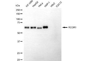 Western blotting analysis using RCOR1 antibody (ABIN7800178).