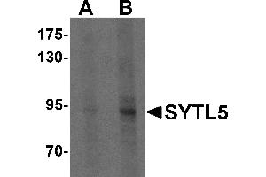 Western blot analysis of SYTL5 in Hela cell lysate with SYTL5 antibody at (A) 1 and (B) 2 µg/mL . (SYTL5 抗体  (N-Term))