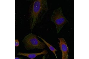 Immunofluorescence staining of methanol-fixed Hela cells using GAP43(Ab-41) Antibody. (GAP43 抗体)