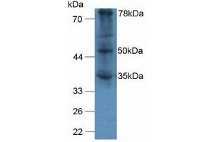 Detection of vWA2 in Human A375 Cells using Polyclonal Antibody to Von Willebrand Factor A Domain Containing Protein 2 (vWA2) (VWA2 抗体  (AA 457-708))