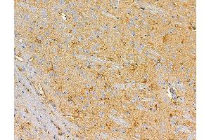 ABIN7095877 and ABIN7099939 at 1/100 staining rat brain tissue by IHC-P. (PLA2G12B 抗体)