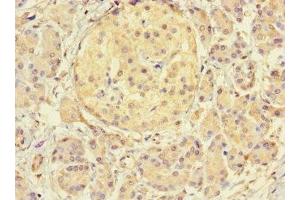 Immunohistochemistry of paraffin-embedded human pancreatic tissue using ABIN7172144 at dilution of 1:100 (THADA 抗体  (AA 432-651))