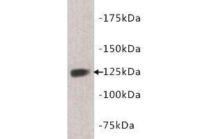 Western Blotting (WB) image for anti-tyrosine Kinase with Immunoglobulin-Like and EGF-Like Domains 1 (TIE1) (N-Term) antibody (ABIN1854998) (TIE1 抗体  (N-Term))
