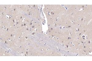Detection of APP in Human Cerebrum Tissue using Polyclonal Antibody to Amyloid Precursor Protein (APP) (APP 抗体  (AA 672-711))