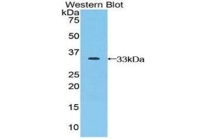 Western Blotting (WB) image for anti-Jagged 2 (JAG2) (AA 714-981) antibody (ABIN3202318) (JAG2 抗体  (AA 714-981))