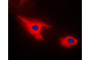 Immunofluorescent analysis of Septin 7 staining in HepG2 cells. (Septin 7 抗体  (C-Term))