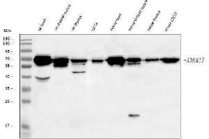 Western blot analysis of Adam17 using anti-Adam17 antibody (ABIN7600652).