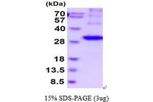 SDS-PAGE (SDS) image for Kallikrein 2 (KLK2) (AA 25-261) protein (His tag) (ABIN6387849) (Kallikrein 2 Protein (KLK2) (AA 25-261) (His tag))