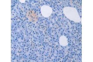 IHC-P analysis of Human Tissue, with DAB staining. (LEFTY1 抗体  (AA 167-332))