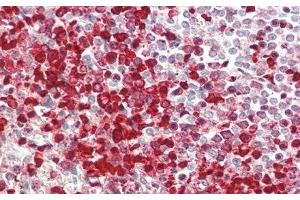 Immunohistochemistry (IHC) image for anti-Interleukin 1 Receptor-Like 1 (IL1RL1) (AA 162-349) antibody (ABIN7437368)