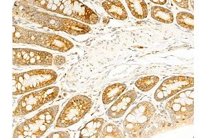 ABIN6257471 and ABIN6274750 at 1/100 staining Rat colorectal tissue by IHC-P. (RPS18 抗体  (C-Term))