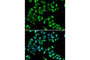 Immunofluorescence analysis of A549 cell using KIAA1456 antibody. (KIAA1456 抗体)