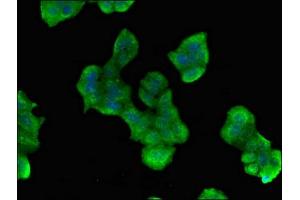 Immunofluorescent analysis of PC-3 cells using ABIN7163021 at dilution of 1:100 and Alexa Fluor 488-congugated AffiniPure Goat Anti-Rabbit IgG(H+L) (PES1 抗体  (AA 378-588))