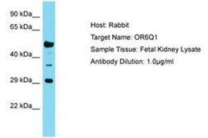 Image no. 1 for anti-Olfactory Receptor, Family 6, Subfamily Q, Member 1 (OR6Q1) (C-Term) antibody (ABIN6750774) (OR6Q1 抗体  (C-Term))