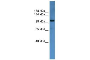 WB Suggested Anti-ZEB1 Antibody Titration:  0. (ZEB1 抗体  (N-Term))