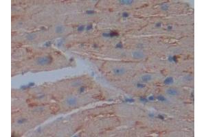 Immunohistochemistry (IHC) image for anti-Basigin (Ok Blood Group) (BSG) (AA 87-323) antibody (ABIN7441883)