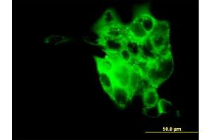 Immunofluorescence of monoclonal antibody to SYT4 on A-431 cell. (SYT4 抗体  (AA 1-99))