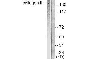 Western blot analysis of extracts from COLO205 cells, using Collagen II antibody (#C0155). (COL2 抗体)