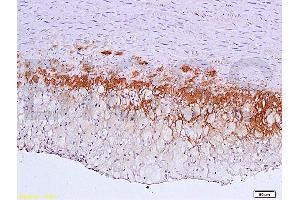 Immunohistochemistry (IHC) image for anti-Transforming Growth Factor, beta Receptor II (70/80kDa) (TGFBR2) (AA 241-330) antibody (ABIN725225)