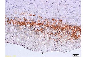 Formalin-fixed and paraffin embedded: rabbit carotid artery labeled with Anti-TGF-beta-R2/TGFBR2 Polyclonal Antibody (ABIN725225), Unconjugated 1:600 followed by conjugation to the secondary antibody and DAB staining (TGFBR2 抗体  (AA 241-330))