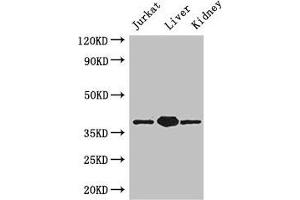 Western Blot Positive WB detected in: Jurkat whole cell lysate, Mouse liver tissue, Mouse kidney tissue All lanes: PINX1 antibody at 3.