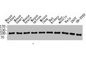 Western Blot analysis of rat-kidney hela 293T SH-SY5Y MOUSE-KIDNEY MOUSE-SPLEEN MOUSE-LUNG using ENPP3 Polyclonal Antibody. (ENPP3 抗体  (Internal Region))