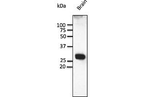 Western Blotting (WB) image for anti-RAB3A, Member RAS Oncogene Family (RAB3A) (C-Term) antibody (ABIN7272977) (RAB3A 抗体  (C-Term))