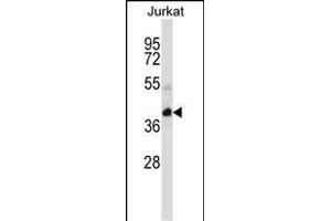 KCTD10 Antibody (C-term) (ABIN657313 and ABIN2846392) western blot analysis in Jurkat cell line lysates (35 μg/lane). (KCTD10 抗体  (C-Term))