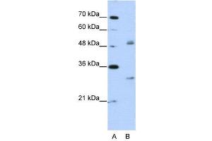 WB Suggested Anti-WBSCR1  Antibody Titration: 2. (EIF4H 抗体  (Middle Region))