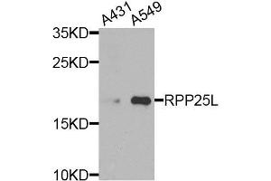 Western blot analysis of A431 and A549 of various cells, using RPP25L antibody. (RPP25L 抗体)