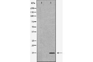 Western blot analysis of Mouse liver tissue lysates, using SPINLW1 Antibody. (Eppin 抗体  (C-Term))