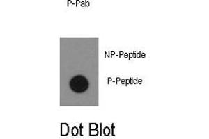 Dot blot analysis of ABL1 (phospho Y134) polyclonal antibody  on nitrocellulose membrane. (ABL1 抗体  (pTyr134))