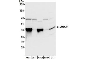 Western Blotting (WB) image for anti-Annexin A1 (ANXA1) (AA 1-50) antibody (ABIN7453913)
